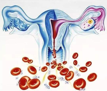 非经期阴道出血 阴道不规则出血如何检查？